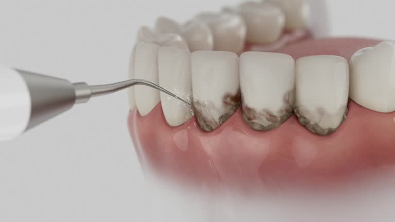 Reliable Emergency Dentist contractor in Dent, OH by Smile Center Dentistry